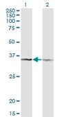 Monoclonal Anti-CD58 antibody produced in mouse clone 3B12-D5, purified immunoglobulin, buffered aqueous solution