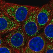 Anti-B3GNT4 antibody produced in rabbit Prestige Antibodies&#174; Powered by Atlas Antibodies, affinity isolated antibody, buffered aqueous glycerol solution