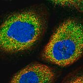 Anti-MARK4 antibody produced in rabbit Prestige Antibodies&#174; Powered by Atlas Antibodies, affinity isolated antibody, buffered aqueous glycerol solution