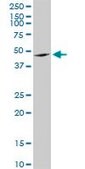 Anti-ANGPTL4 antibody produced in mouse purified immunoglobulin, buffered aqueous solution