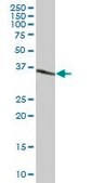 Anti-MKI67IP antibody produced in mouse purified immunoglobulin, buffered aqueous solution