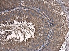 Anti-SKA1 antibody produced in rabbit affinity isolated antibody, buffered aqueous solution