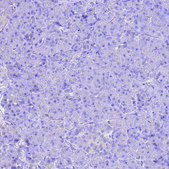 Anti-IL2RG antibody produced in rabbit Prestige Antibodies® Powered by Atlas Antibodies, affinity isolated antibody, buffered aqueous glycerol solution