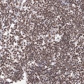 Anti-HNRNPM antibody produced in rabbit Prestige Antibodies&#174; Powered by Atlas Antibodies, affinity isolated antibody, buffered aqueous glycerol solution