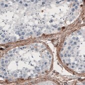 Monoclonal Anti-FN1 antibody produced in mouse Prestige Antibodies&#174; Powered by Atlas Antibodies, clone CL3730, purified immunoglobulin, buffered aqueous glycerol solution