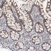 Anti-MAGEE2 antibody produced in rabbit Prestige Antibodies&#174; Powered by Atlas Antibodies, affinity isolated antibody, buffered aqueous glycerol solution