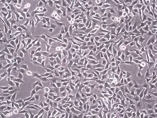 sBT-RMS Spontaneous Brain-tropic RET Melanoma-sorted Mouse Cell Line