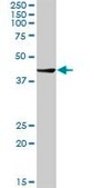 Anti-CTBS antibody produced in rabbit purified immunoglobulin, buffered aqueous solution
