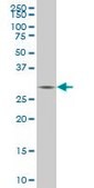 Monoclonal Anti-TGIF2, (C-terminal) antibody produced in mouse clone 6A8, purified immunoglobulin, buffered aqueous solution