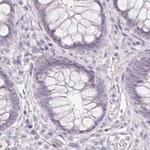Anti-ACAN antibody produced in rabbit Prestige Antibodies&#174; Powered by Atlas Antibodies, affinity isolated antibody