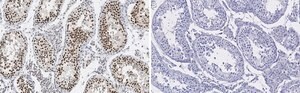 Anti-HDAC2 Antibody, clone 1E22 ZooMAb® Rabbit Monoclonal recombinant, expressed in HEK 293 cells