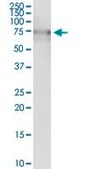 Anti-ALPL antibody produced in rabbit purified immunoglobulin, buffered aqueous solution