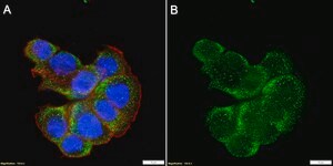 Anti-MAL2 Antibody, clone 1K18 ZooMAb&#174; Rabbit Monoclonal recombinant, expressed in HEK 293 cells