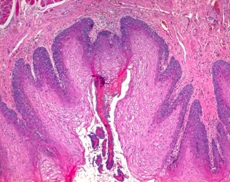 Phloxin B（C.I.45410） for microscopy Certistain&#174;