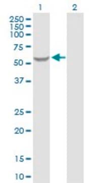Anti-GK2 antibody produced in rabbit purified immunoglobulin, buffered aqueous solution