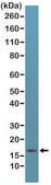 Anti-p16ink4a (CDKN2A) antibody, Rabbit monoclonal recombinant, expressed in HEK 293 cells, clone RM267, purified immunoglobulin