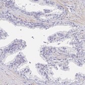 Anti-AKAP14 antibody produced in rabbit Prestige Antibodies&#174; Powered by Atlas Antibodies, affinity isolated antibody, buffered aqueous glycerol solution
