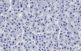 Anti-RORγ Antibody, clone 1D13 ZooMAb® Rabbit Monoclonal recombinant, expressed in HEK 293 cells