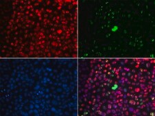 Anti-Phospho-ATM-S1981 antibody produced in rabbit