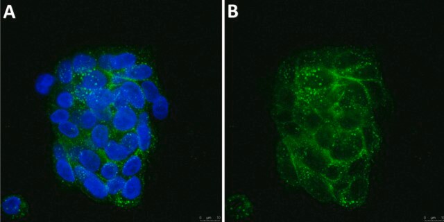 Anti-FGFR4 Antibody, clone 3A11