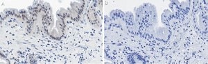 Anti-Nrf2 Antibody, clone 5B20 ZooMAb&#174; Rabbit Monoclonal recombinant, expressed in HEK 293 cells