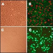Human Aortic Endothelial Cells: HAOEC, adult