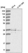 Anti-RNF220 antibody produced in rabbit Prestige Antibodies&#174; Powered by Atlas Antibodies, affinity isolated antibody