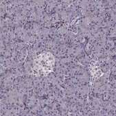 Anti-PGM5 Prestige Antibodies&#174; Powered by Atlas Antibodies, affinity isolated antibody