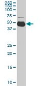 Monoclonal Anti-SERPINI1, (C-terminal) antibody produced in mouse clone 1E10, purified immunoglobulin, buffered aqueous solution