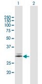 Anti-FAHD2A antibody produced in mouse IgG fraction of antiserum, buffered aqueous solution