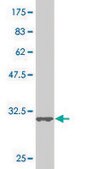 Monoclonal Anti-SMAD5 antibody produced in mouse clone 4F10, purified immunoglobulin, buffered aqueous solution