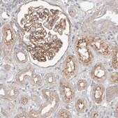 Anti-MAT2B antibody produced in rabbit Prestige Antibodies&#174; Powered by Atlas Antibodies, affinity isolated antibody, buffered aqueous glycerol solution