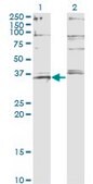 ANTI-FOXL1 antibody produced in mouse clone 2C3, purified immunoglobulin, buffered aqueous solution