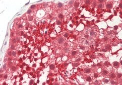 Anti-UCHL3 (C-terminal) antibody produced in rabbit affinity isolated antibody