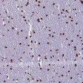 Anti-TIMM29 antibody produced in rabbit Prestige Antibodies&#174; Powered by Atlas Antibodies, affinity isolated antibody, buffered aqueous glycerol solution