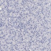 Anti-ITGA8 antibody produced in rabbit Prestige Antibodies&#174; Powered by Atlas Antibodies, affinity isolated antibody, buffered aqueous glycerol solution