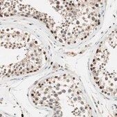 抗-ETV4 兔抗 Prestige Antibodies® Powered by Atlas Antibodies, affinity isolated antibody, buffered aqueous glycerol solution