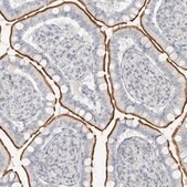 Anti-OSBPL7 antibody produced in rabbit Prestige Antibodies® Powered by Atlas Antibodies, affinity isolated antibody, buffered aqueous glycerol solution