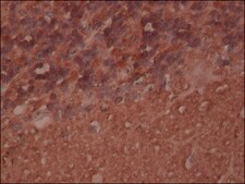Anti-Neuron-Specific Enolase (NSE), Mouse monoclonal clone NSE-P1, purified from hybridoma cell culture
