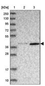 Anti-ABLIM1 antibody produced in rabbit Prestige Antibodies&#174; Powered by Atlas Antibodies, affinity isolated antibody, buffered aqueous glycerol solution