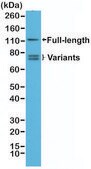 Anti-AR (n-terminal) antibody, Rabbit monoclonal recombinant, expressed in HEK 293 cells, clone RM254, purified immunoglobulin