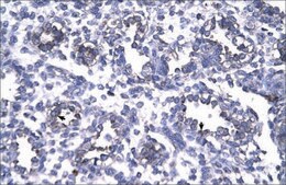 Anti-FOXP1 antibody produced in rabbit IgG fraction of antiserum