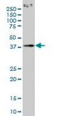 Monoclonal Anti-PCYT1A antibody produced in mouse clone 6E6, purified immunoglobulin, buffered aqueous solution