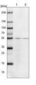 Anti-TUBB8 antibody produced in rabbit Prestige Antibodies® Powered by Atlas Antibodies, affinity isolated antibody, buffered aqueous glycerol solution