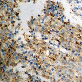 Anti-phospho-Tau (pSer519/202) antibody produced in rabbit affinity isolated antibody