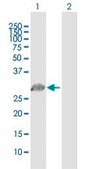 Anti-PRRX1 antibody produced in mouse purified immunoglobulin, buffered aqueous solution