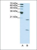 Anti-SNRPF antibody produced in rabbit IgG fraction of antiserum