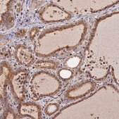 Anti-PEX3 antibody produced in rabbit Prestige Antibodies&#174; Powered by Atlas Antibodies, affinity isolated antibody, buffered aqueous glycerol solution