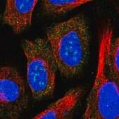 Anti-ZCCHC2 antibody produced in rabbit Prestige Antibodies&#174; Powered by Atlas Antibodies, affinity isolated antibody, buffered aqueous glycerol solution