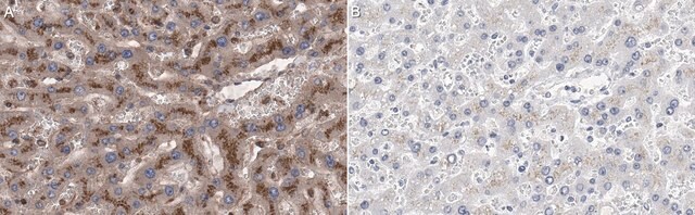 Anti-LAMP2/CD107b Antibody, clone H4B4